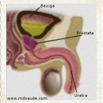 DOR AO URINAR | Principais causas