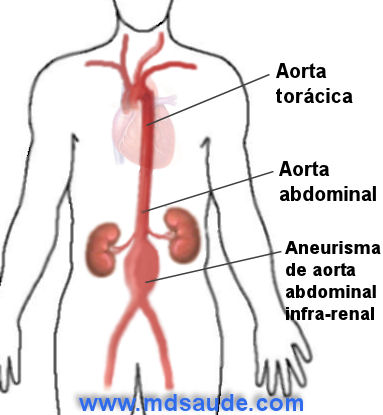 Artéria aorta