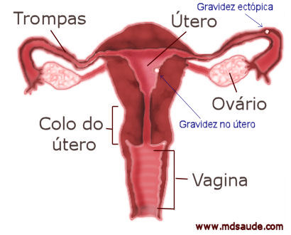 Sintomas de envenenamento com parasitas