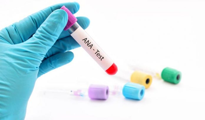 ANA-test Anticuerpo antinuclear