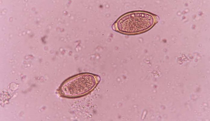 Trichuris-trichiura Trichuris trichiura