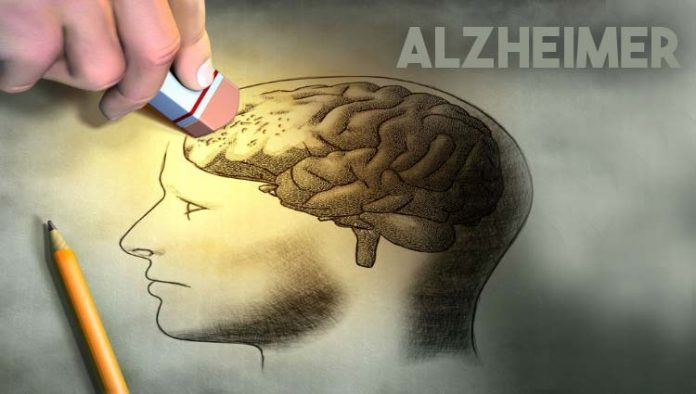 alzheimer-ilustracao Alzheimer
