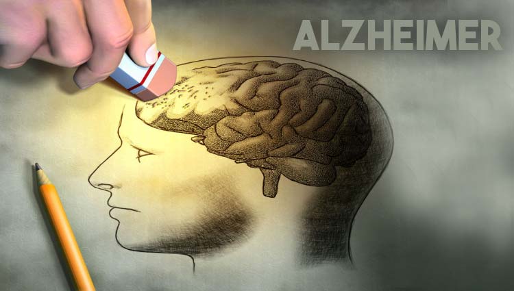 Resultado de imagem para imagens de alzheimer