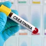 Exame de ureia e creatinina