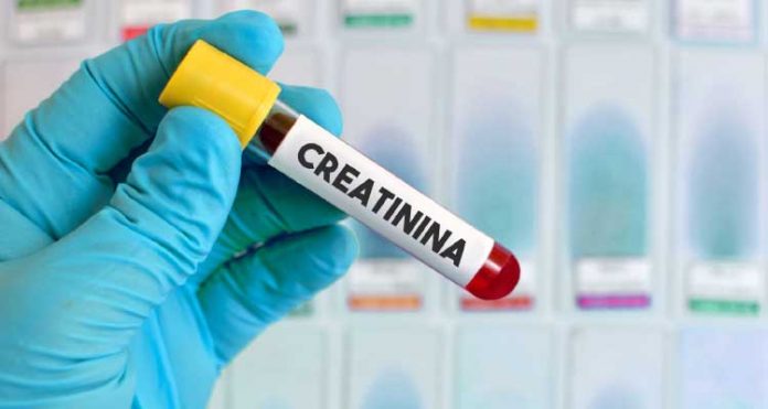 creatinina-ilustracao creatinina