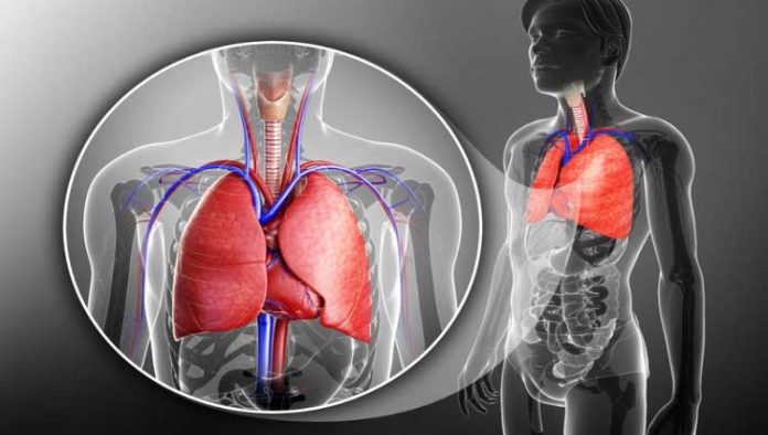 derrame-pleural-ilustracao Derrrame pleural
