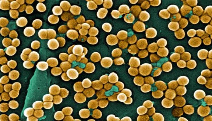 estafilococos Staphylococcus aureus