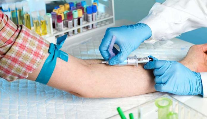 exames-de-sangue-imagem Exame de sangue