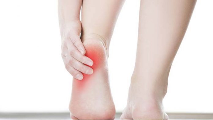 fascite-plantar Fascite plantar