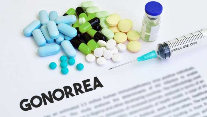 gonorrea gonorrea