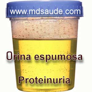 La osteocondrosis difundida la invalidez dan o no
