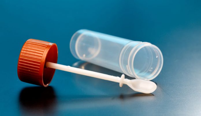 Dieta para exame de sangue oculto