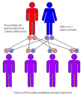Legenda: r = gene defeituoso; R = gene normal.
Vermelho = anemia falciforme; Roxo = traço falciforme; Azul = normal.