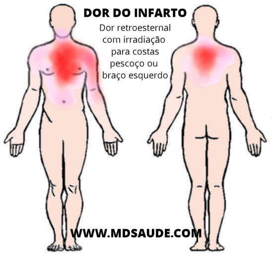 Sintomas do infarto agudo do miocárdio