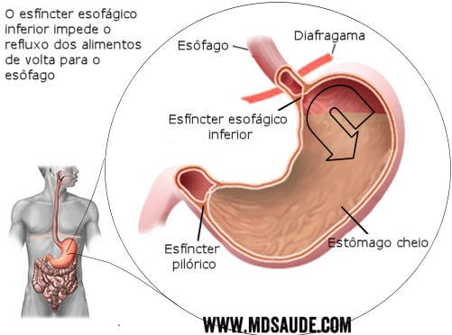 Por que se hincha el estomago