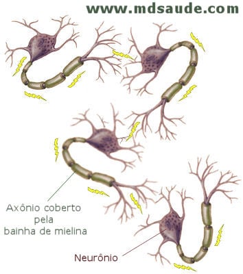 Esclerose múltipla