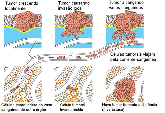 Informações sobre Câncer em Português, Cancer Information in Portuguese