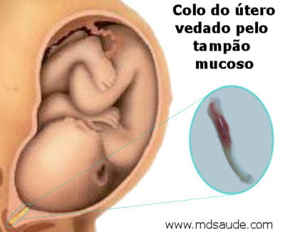 Sangramento vaginal é sinal de alerta na gravidez - Tua Saúde