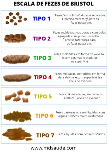 A: fezes diarreicas com secreção mucoide, com grandes quantidades