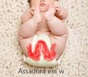 Assadura do bebê