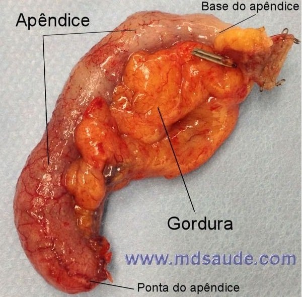 Apêndice - foto