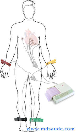 ¿QUE ÉS UN ELECTROCARDIOGRAMA (ECG)? 2 ECG