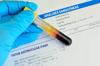 Fator antinuclear (FAN)