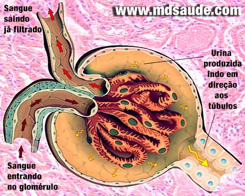 Glomerulopatia