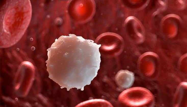 Anemia ou leucemia