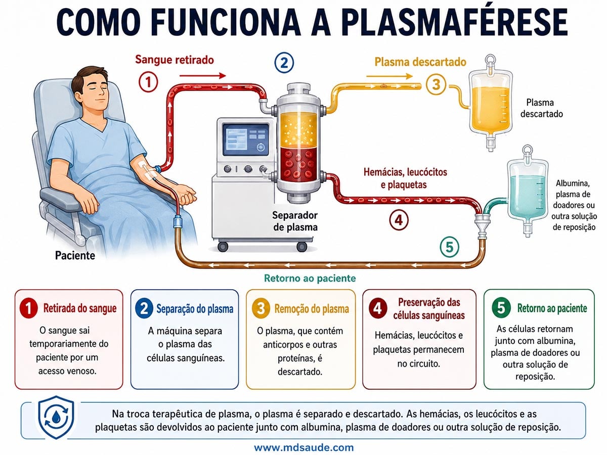 Como funciona a plasmaférese