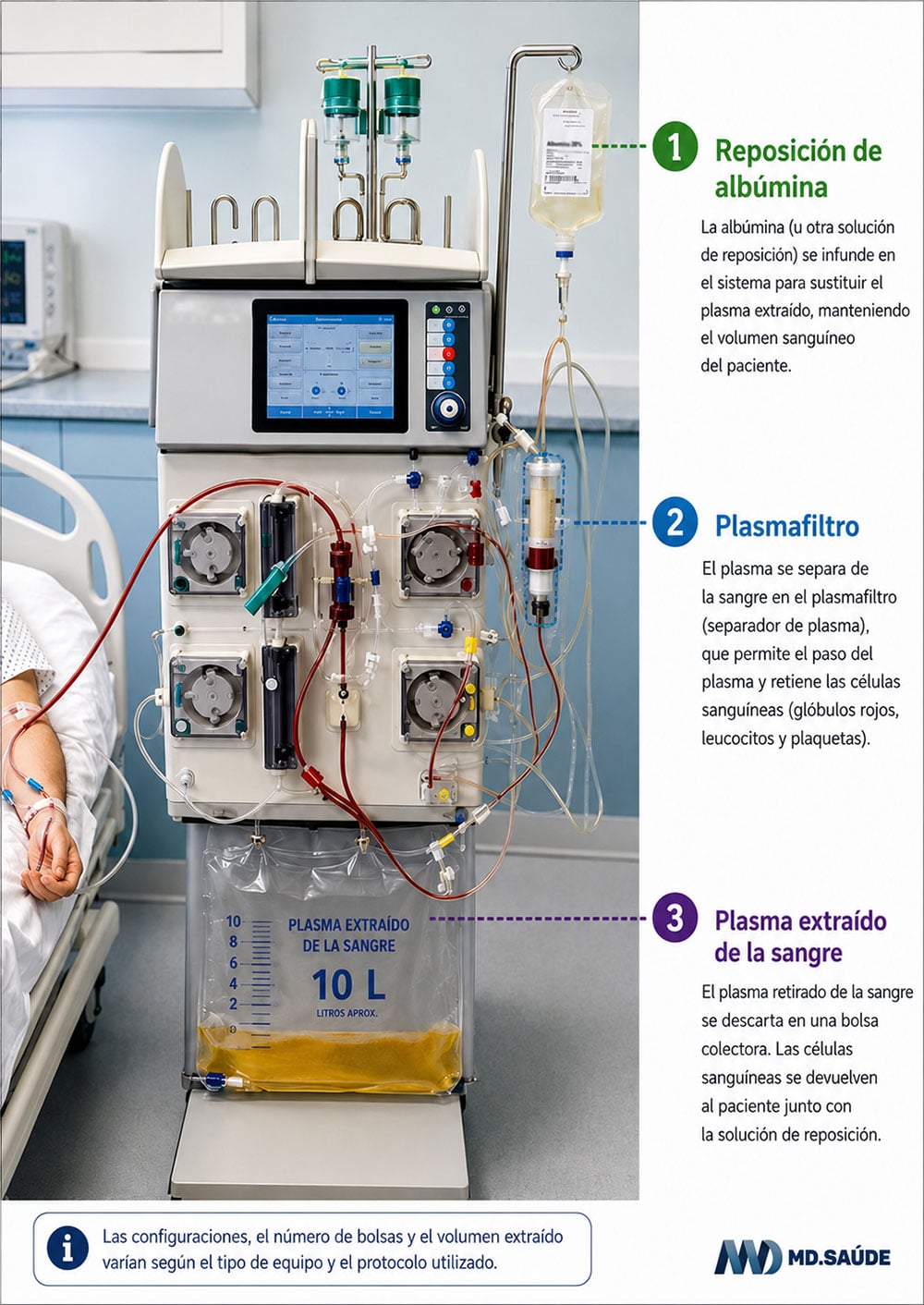 Plasmaféresis