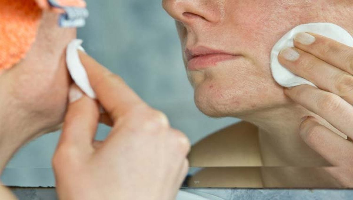 roacutan más barato