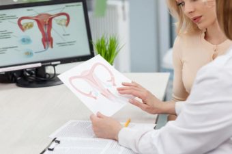 ADENOMIOSE UTERINA – Sintomas, causas e tratamento