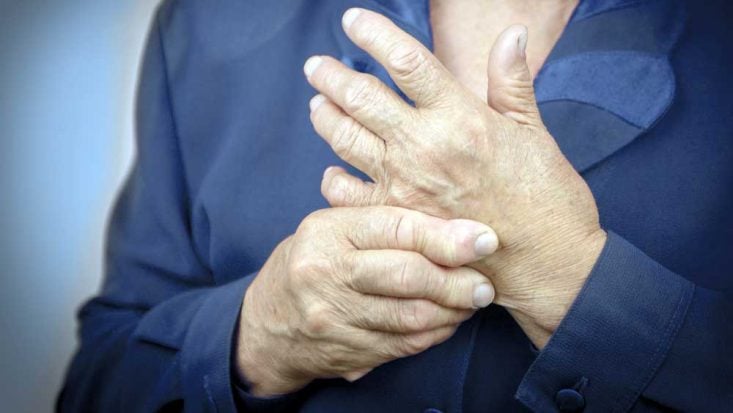 Fotos de artrite reumatoide