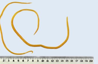 Ascaris lumbricoides