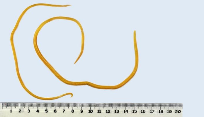 ascaris-imagem Ascaris lumbricoides