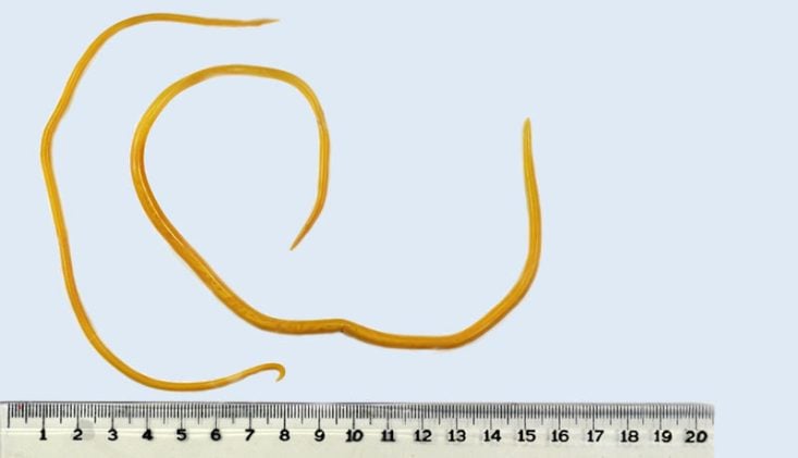 Ascaris lumbricoides