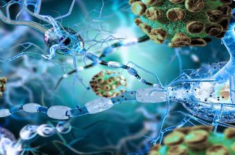 ENFERMEDADES AUTOINMUNES – Causas, síntomas y tratamiento