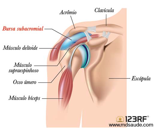 bursita subdeltoidiana
