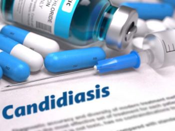 Candidiasis Genital Masculina Puede Cogerse Sin Haber Tenido