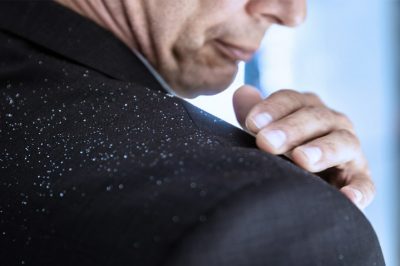 CASPA – Causas, sintomas e tratamento