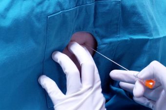 Cefaleia de baixa pressão