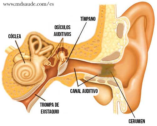 Formação do tampão de cera no ouvido