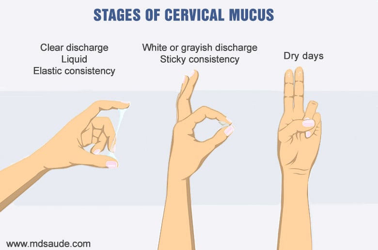 Vaginal discharge, also known as leukorrhea, is thin, clear, or