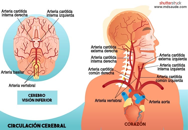 arteria carótida