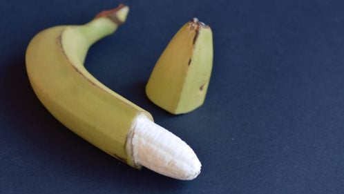Circuncisión: qué es, riesgos, beneficios y postoperatorio