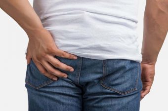 CISTO PILONIDAL – Causas, sintomas e cirurgia