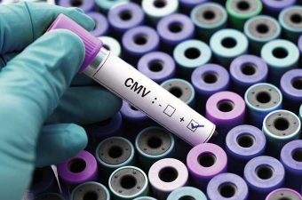 Citomegalovírus