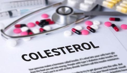 ¿Necesito tomar medicamentos para reducir el colesterol?