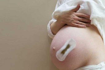 Corrimento na gravidez